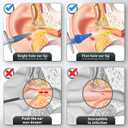 Ear Wax Removal, Ear Cleaner, Ear Cleaning Kit, Manual Ear Irrigation Flushing System, Ear Wax Removal Kit, Safe and Effective to Clean Ear Built Up Wax