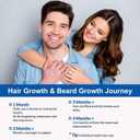 2 x 5% Minoxidil Foam, Minoxidil for Men Foam, Minoxidil for Women Hair Growth, Minoxidil for Men and Women. (2 Ounce)