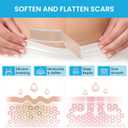Silicone Scar Sheets Soft Silicone Scar Tape Roll, Reusable Scar Silicone Strips for Surgical Scars, Keloid, Acne Scars, Burn Scar, C-Section (1.6"x 120" Roll)