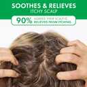 Dercos Selenium Sulfide Anti Dandruff Shampoo, Dry Scalp Treatment and Itch Relief. Prescription Strength Comparable to 2% Ketoconazole, for Mild to Severe Dandruff-Prone Hair & Flaky, Itchy Scalps (6.76 Fl Oz (Pack of 1))