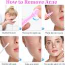 Acne Treatment Kit, 100 Disposable Needles and 144 Pimple Patches, Blackhead and Blemish Removal Tools