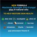 Fungi-Nail Anti-Fungal Liquid Solution, 1 Fl Oz (Pack of 1), Kills Fungus, Athletes Foot Treatment, Toe Nail Fungus Treatments w/Tolnaftate, Clinically Proven to Cure and Prevent Fungal Infection