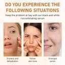 Rice Exfoliant Ampoule Duo, Black and White Face Peeling Solution, Moisturizing Pore Minimizer, 2-Pack, 100ml