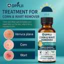 Wart Remover Liquid with Salicylic Acid for Wart Removal & Corn Care, Targeted Application, 1.01 Fl Oz