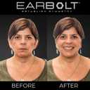EARBOLT - Ear Pinning Adhesives | Cosmetic Ear Correctors, Pack of 20