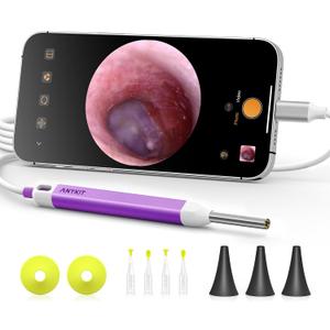 Anykit Digital Otoscope with Gyroscope, HD Ultra Clear View Ear Camera with Ear Wax Removal Tools, Video Ear Scope Otoscope with Light, Compatible with Android, iPhone 15 (Purple)