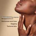 StriVectin Tighten and Lift Peptight Face Lift Serum with Tightening and Brightening Peptides for Wrinkles (1.7 Fl Oz (Pack of 1))