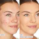 tarte BB blur tinted moisturizer Broad Spectrum SPF 30 Medium Buildable Coverage with Natural Lightweight Matte Finish, Vegan & Cruelty Free