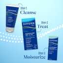 Differin Acne Treatment Gel, 30 Day Supply, Retinoid Treatment for Face with 0.1% Adapalene, Gentle Skin Care for Acne Prone Sensitive Skin, 15g Tube 