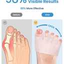 Toe Separators for Women - Podiatrist Recommended, Toe Spacers for Men, Breathable Bunion Corrector, Plantar Fasciitis(1 Pair)