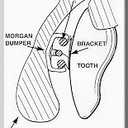 Morgan Bumper Braces Cover Lip Protector for Orthodontic Patients - Clear - Qty 2