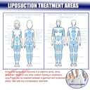 3 Pack Lipo Foam Board Ab Board Post Surgery Liposuction Abdominal Flattening Compression Board BBL Lumbar Molder Backboard For Liposuction