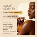 Glo Melanin Brightening Body Oil Topical Moisturizer with Vitamin C, Kojic Acid & Turmeric Lightweight Hydrating Cosmetic Oil for Melanin-Rich Skin (8 oz / 230 ml)