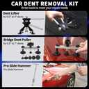 Super PDR Car Dent Puller Kit, 169PCS Paintless Dent Removal Kit, Hail Dent Repair Kit Can Removal 99% of Car Dents in 30 Minutes for Repairing Big Dents, Small Dents, Dings and Hail Damage (EXP 08/01/26)