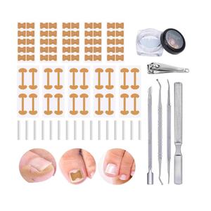 Ingrown Toenail Corrector Set with Correction Strips, Professional Ingrown Toenail Removal Kit, Toenail Correction Strips & Ingrown Toenails Pedicure Tool Set for Home Pedicure Care