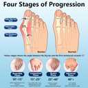 Silicone Toe Separators Sleeves for Bunions Women & Men, Hallux Valgus Relief - Toe Straightener & Spacer (2 Pairs, Transparent)