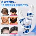 5% Minoxidil for Men and WomenMinoxidil hair growth productsIntense Hair Growth SerumMay Promote Faster, Stronger, Thicker Hair Growth to Fight Hair Loss and Thinning Hair2.82 oz*2)