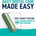 ORAVET Dental Chews for Dogs, Oral Care and Hygiene Chews (Large Dogs, Over 50 lbs.) Pink Pouch, 30 Count (Pack of 1) EXP: 05/21/2026