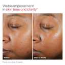 EltaMD UV Clear Face Sunscreen, Oil Free Sunscreen for Sensitive Skin with Zinc Oxide, Dermatologist Recommended