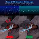Anti Snoring Device - Mini SleepApnea Devices - Variable Anti Snoring Aid - Upgraded StopSnoring Solution - Suitable for All Nose Shapes - Blue - L18