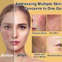 Skin Care Set for Teens Women,Anti-Aging Deeply Hydrates Repairs Skincare Gift Set for All Skin,Facial Skin Care Products Routine Kit Christmas Beauty Gift Set for Women