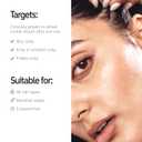 The INKEY List Salicylic Acid Exfoliating Scalp Treatment 5 Fl Oz, Hydrating Scalp Oil, Moisturizing Scalp Scrub, Suitable For All Hair Types