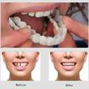 Snap-On Veneers - Professional DIY Smile Correction Kit for Men & Women - Comfortable, Natural White Top & Bottom Set - Perfect for Hiding Gaps, Stains & Missing Teeth - Easy Home Fit
