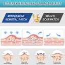 Silicone Scar Sheets (1.6" X 197" Roll-5M), Professional Silicone Scar Tape, Fit for Surgical Scars, Tummy Tuck, Keloid, Burn Scar, Wrinkles