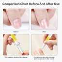 Rejuvenation Nail Growth Oil, Nail Oil For Growth And Strength Rejuvenation,Nail Strengthener and Growth with Nails File (2PCS)