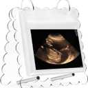 Flip Ultrasound Photo Album with Stand, Refillable Flip-Through Display for 3x4 Pictures, Acrylic Scalloped Cover, Pregnancy Gift for New Parents (Small)