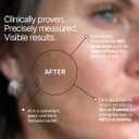 BeMe Liquid Collagen for Women - 2500mg Verisol Collagen Liquid with Biotin, CoQ10 & Vitamin C - Clinically Proven Collagen Peptides for Hair, Skin & Nails - 15 Mixed Berry Sachets