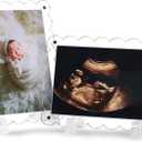 Sonogram Picture Frame Dual, Magnetic Ultrasound Frame with Stand - 2 Pack Clear Acrylic Scalloped Edge for Pregnancy Announcement, Baby Shower Gifts