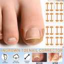 Ingrown Toenail Corrector Set with Breathable Ingrown Toenail Strips Curved Toenails Corrector Patch, File and Lifter Professional Pedicure Tools for Women and Man