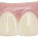Imako Premium Cosmetic Uppers for Men and Women Temporary Smile Makeover 1 Pack Small, Natural White Made in USA