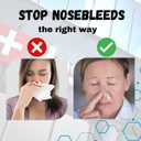 Dental Cotton Rolls 2000 Count | Absorbent Nose Bleed Stoppers and Nose Plugs for Dental Procedures, Wisdom Teeth Recovery, and Medical Use | Soft, Gentle, and High-Quality Cotton Supplies