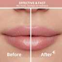 Facial Hair Removal for Women, Electric Rechargeable Painless Hair Remover for Face, Upper Lips, Chin, Peach Fuzz, with LED Light