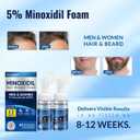 5% Minoxidil Foam, Minoxidil for Men Foam, Minoxidil for Women Hair Growth, Minoxidil for Men and Women. (4 Ounce)