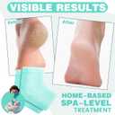 3 Pairs Fuzzy Moisturizing Heel Socks for Dry Cracked Feet Women, Cracked Heel Repair, Cracked Heel & Dry Foot Treatment (Mint Green)