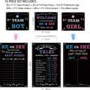 Baby Gender Reveal Party Supplies Kit, Photo Props Games Decorations,Boy or Girl, Includes 3 Game Posters (11x17), 3 Signs (8x10), 1 Erasable Marker, 48 Blue and Pink Voting Stickers