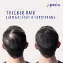 XPECIA FOR MEN ANTI HAIR LOSS DHT BLOCKER NEW HAIR GROWTH FORMULA 60 TABLETS, BBD  11/2028