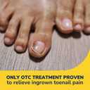 Dr. Scholl's INGROWN TOENAIL PAIN RELIEVER & TRIMMING KIT, 0.3 oz // Only OTC Treatment Proven to Relieve Ingrown Toenail Pain - Includes Medicated Gel + Foam Rings + Bandages + Clipper & Pusher Tools