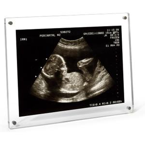 5x7 Ultrasound Picture Frame, Sonogram Picture Frame with Magnetic Back Clear Acrylic Baby Keepsake for Refrigerator, Pregnancy Announcement, Gender Reveal, New Mom Gift(Rectangle - No Stand)