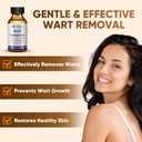 6 x "STAY STOKED" Wart Remover, 15ml Fast-Acting Wart Freeze Off with Natural Herbal Extracts - Gentle Yet Powerful for Common Warts, Plantar Warts on Hands/Feet-0123