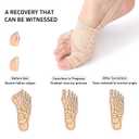 2 Pairs Bunion Corrector for Women Menbig Toe Straightener Big Pads Men Relief Cushions Hammer Splint Spacers Brace Separators Correction Hallux Valgus Sleeve Pain Socks Pinky Beige 2 P Small (Beige, S)