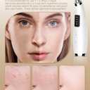 Rechargeable Blackhead Vacuum Pore Cleaner - 5 Attachments & 3 Suction Levels for Deep Facial Cleansing, USB-Powered Blackhead Remover for Women and Men (White)