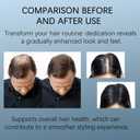 Hair Growth Essence Roll-On Bottle  3% Rosemary, 3% Redensyl, and 2% Anagain  Lightweight, non-greasy scalp essence, free of preservatives and sulfates  Suitable for both men and women (1) (0.84 Fl Oz (Pack of 1))