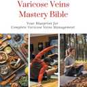 The Varicose Veins Mastery Bible: Your Blueprint for Complete Varicose Veins Management, Paperback