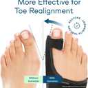 Caretras 2-Pack Bunion Corrector for Women & Men, Orthopedic Bunion Splint for Hallux Valgus Pain Relief, Big Toe Separator, Adjustable Day/Night Support, Comfortable Hammer Toe Straightener