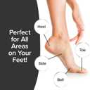 PedEgg Foot File Traps Shavings Inside for Mess-Free Use Painless Callus Remover with Ergonomic Handle for Tough, Dry Skin & Smooth, Soft Feet