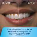 Waterpik Cordless Express Water Flosser, Battery Operated & Portable for Travel & Home, ADA Accepted, Waterproof for Shower Use, White WF-02